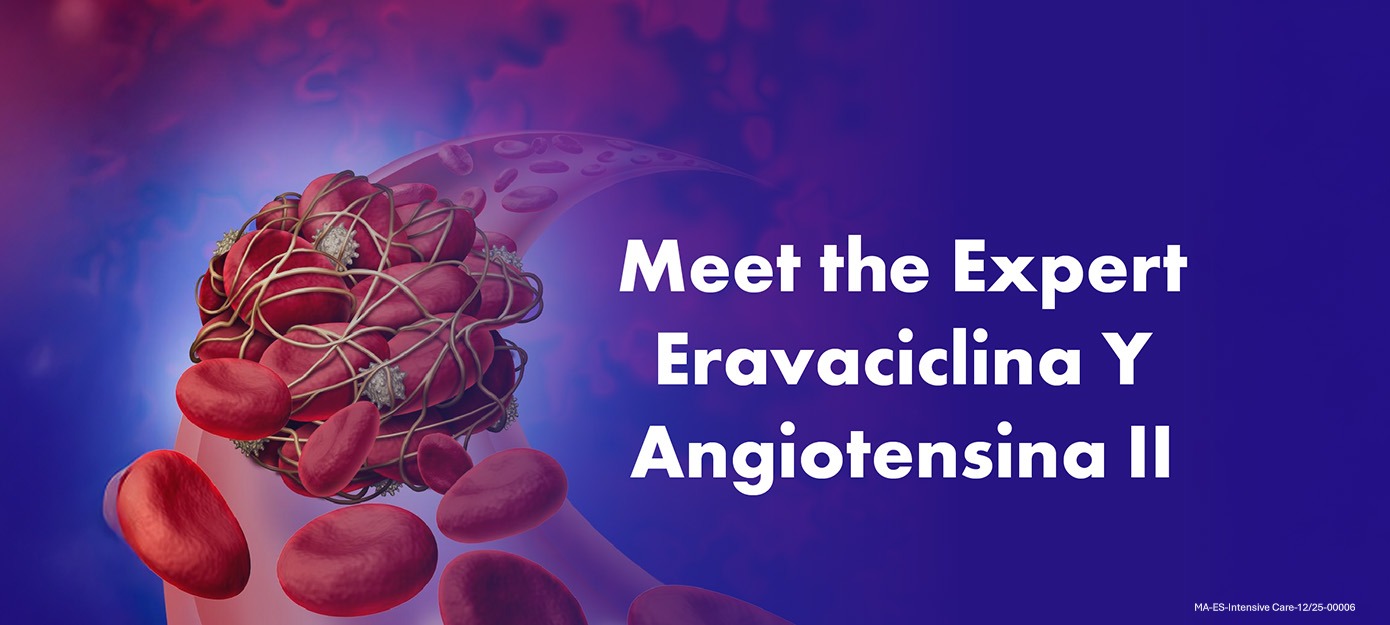 Webinar Meet the Expert - banner